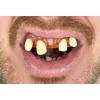 Billy Bob Tiger Hillbilly Fake Teeth With Fixer