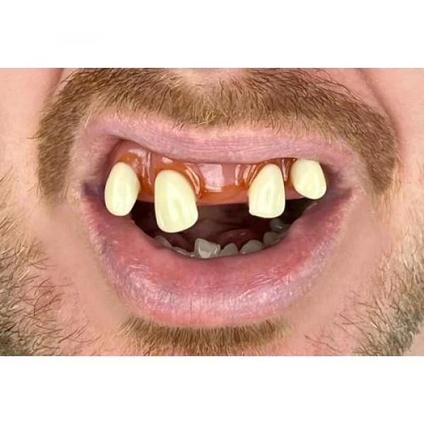 Billy Bob Tiger Hillbilly Fake Teeth With Fixer